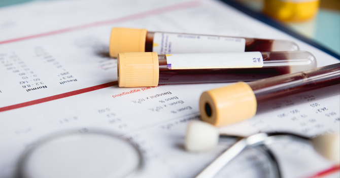 Medical ampoules