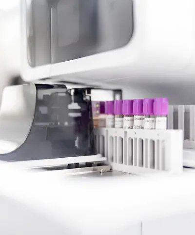 Simon-Kucher insights: How liquid biopsies are driving change in cancer care