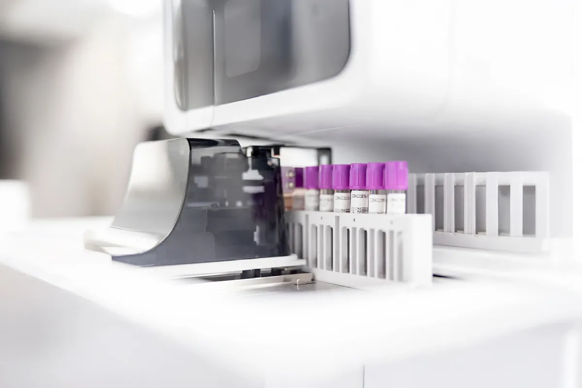 Simon-Kucher insights: How liquid biopsies are driving change in cancer care